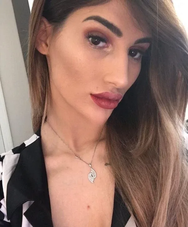 ROSA_ANAL